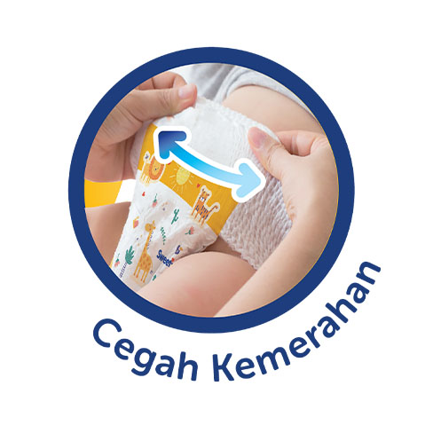 Karet Pinggang Elastis Cegah Kemerahan